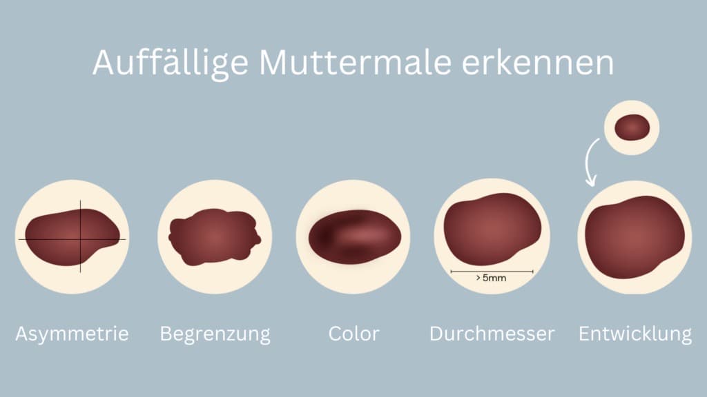 ABCDE-Regel