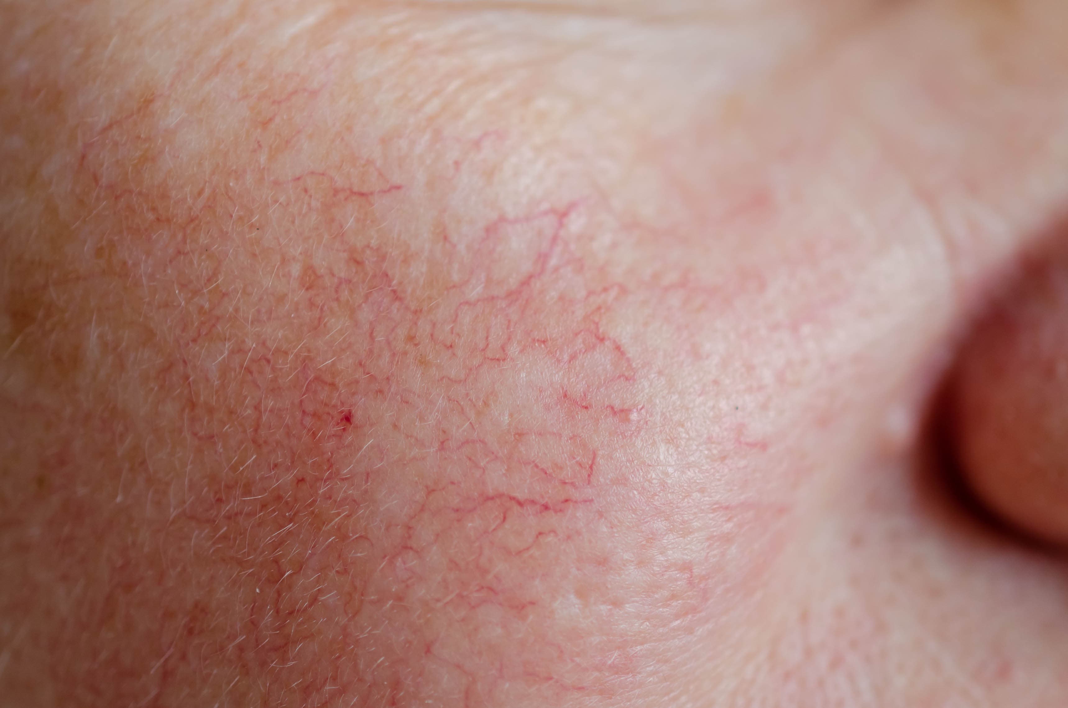 Feine rote Linien